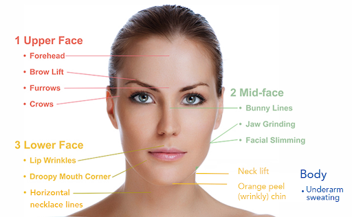 Wrinkle treatment areas skin perfect brothers