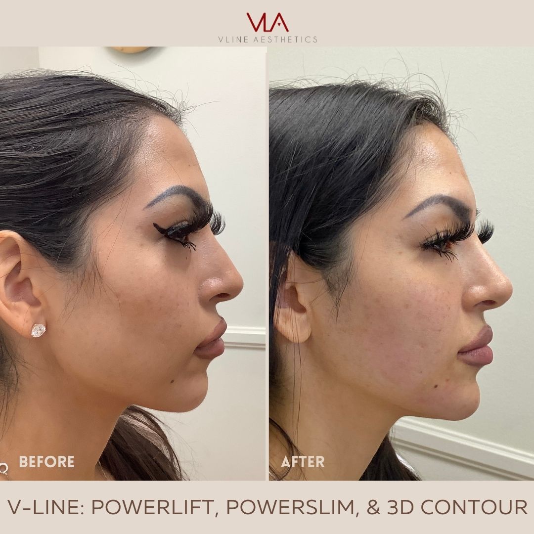 6) 3D Contour