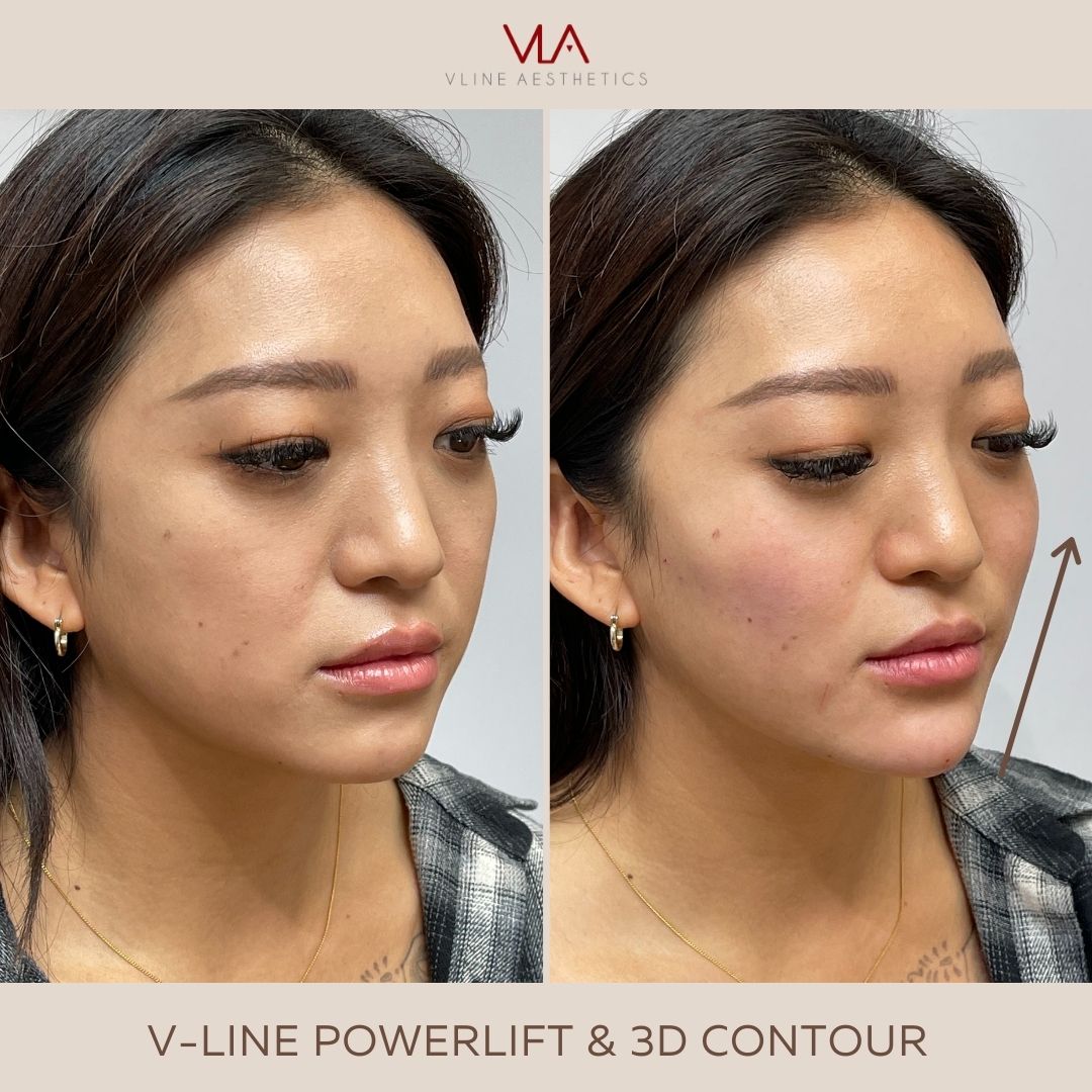 3d contour