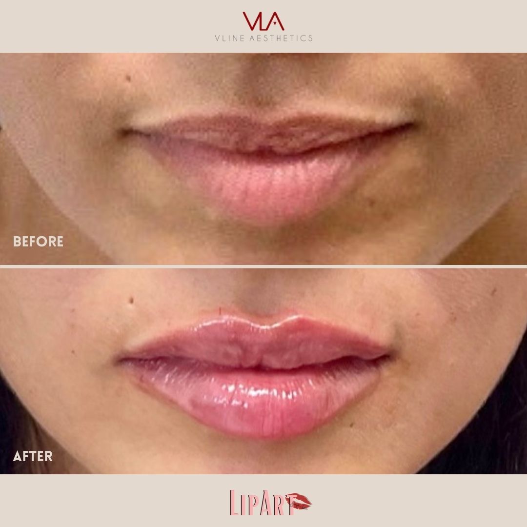 Skin Perfect Brothers LIP Art