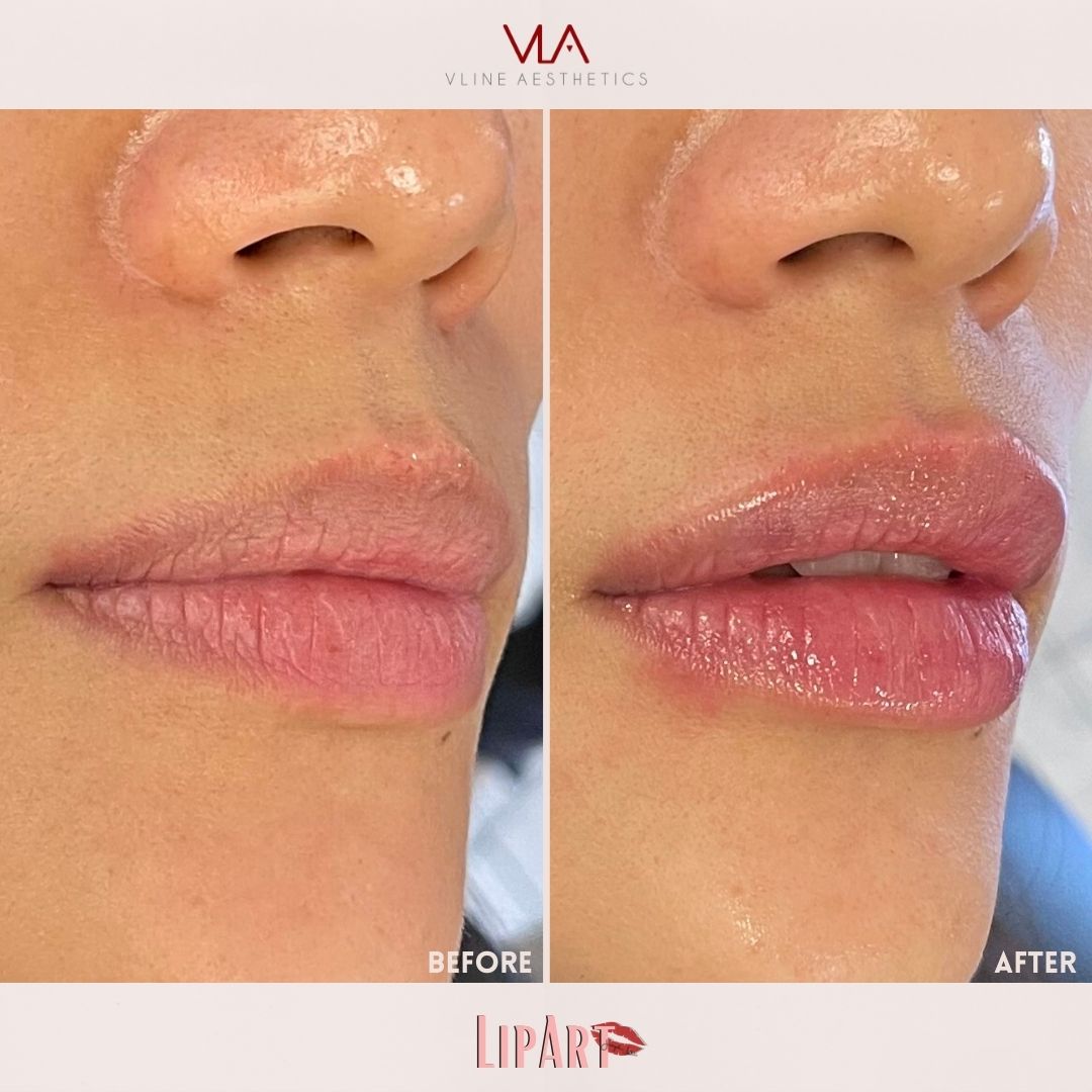 Skin Perfect Brothers LIP Art