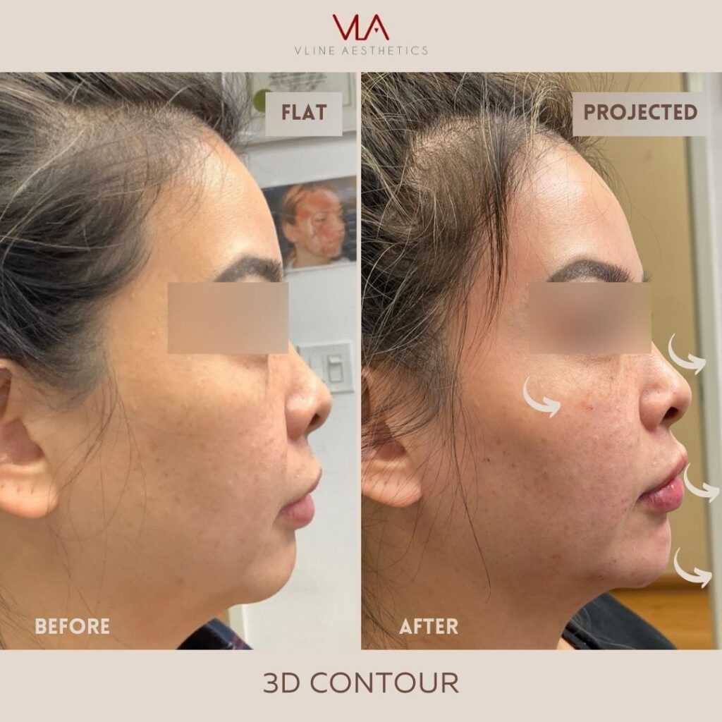 Face Contour Skin Perfect Brothers
