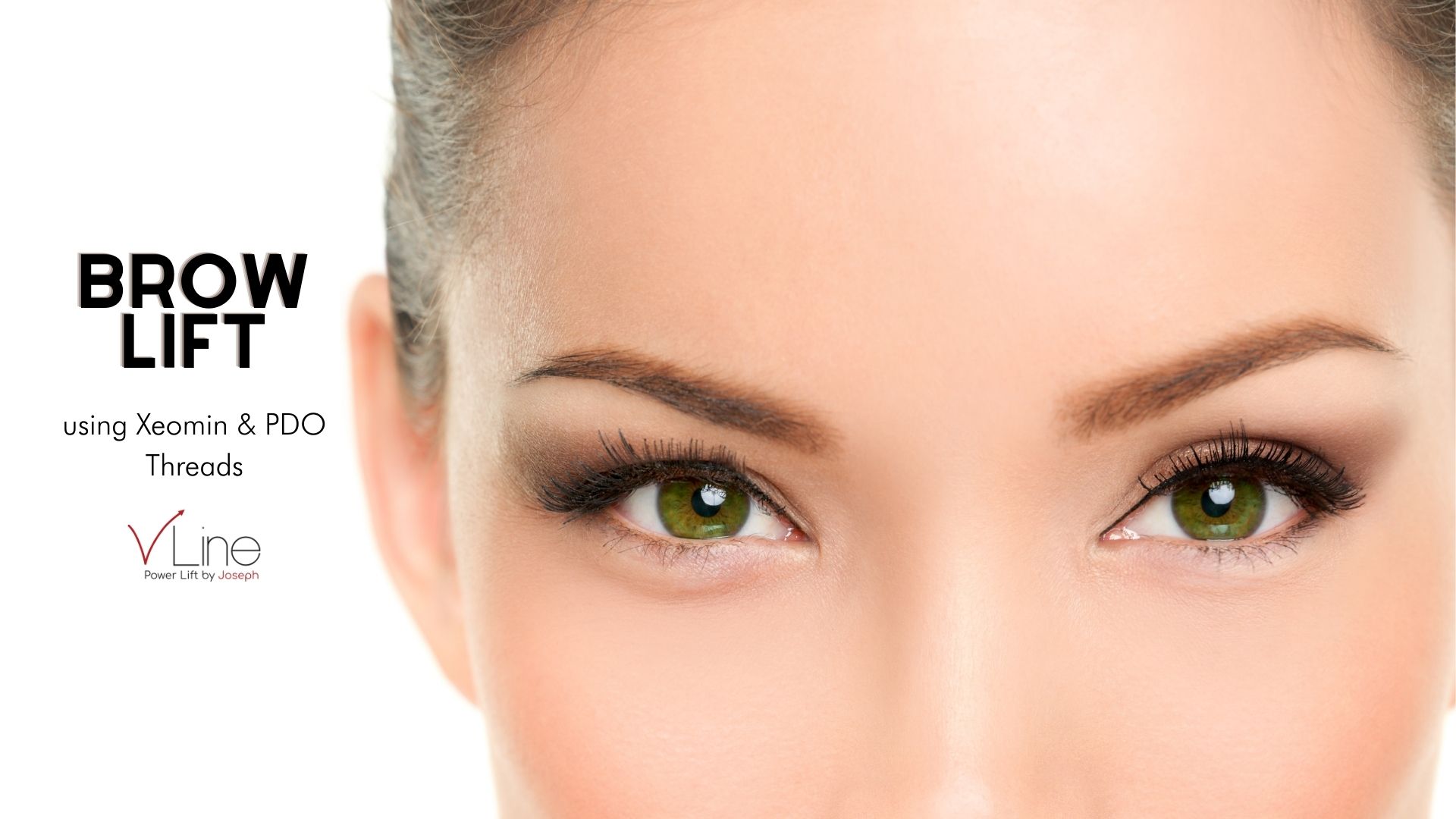 brow lift