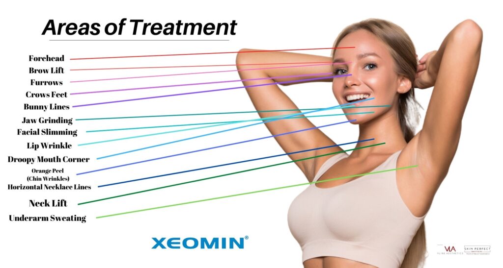 wrinkle treatment areas