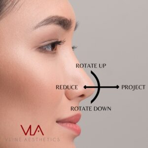 Nose Projection Guide skin perfect brothers