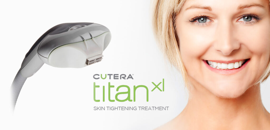 cutera titan laser genesis skin perfect brothers
