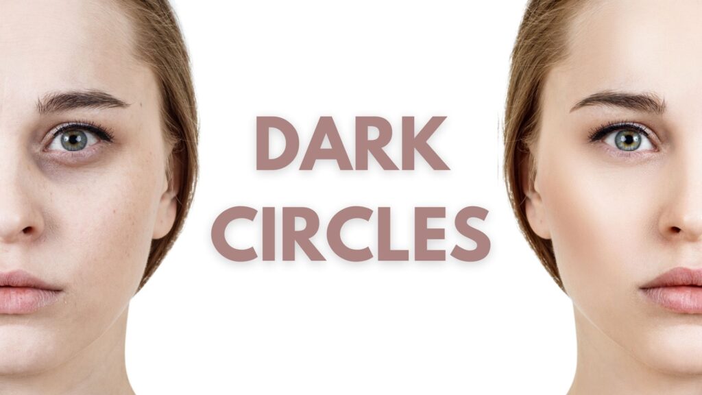 eye rejuvenation dark circles skin perfect brothers