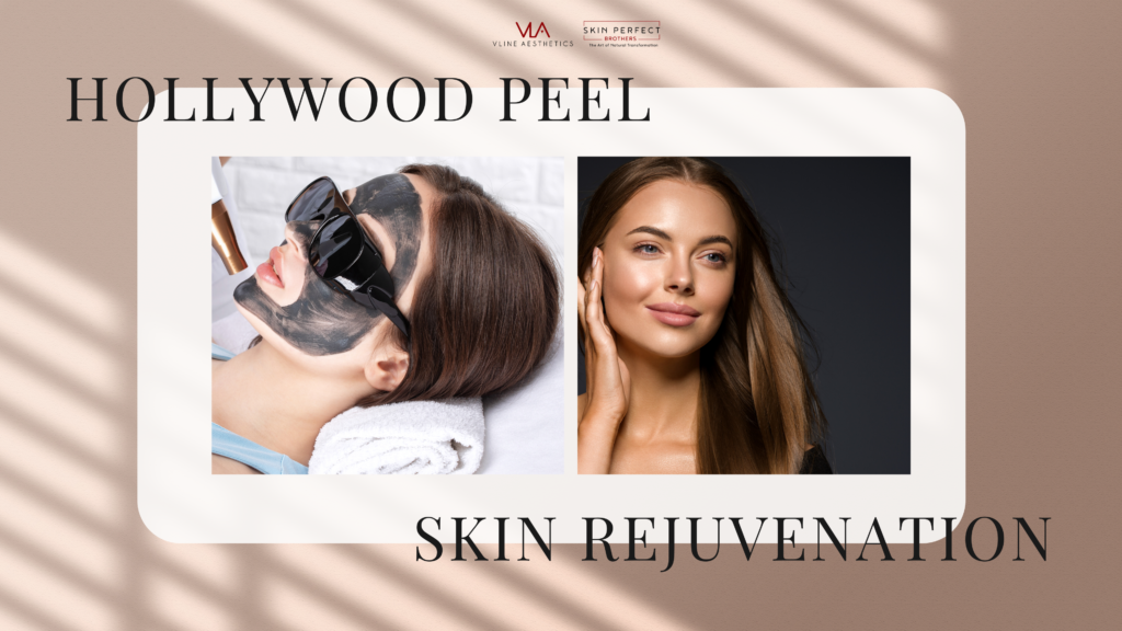 spectra hollywood peel