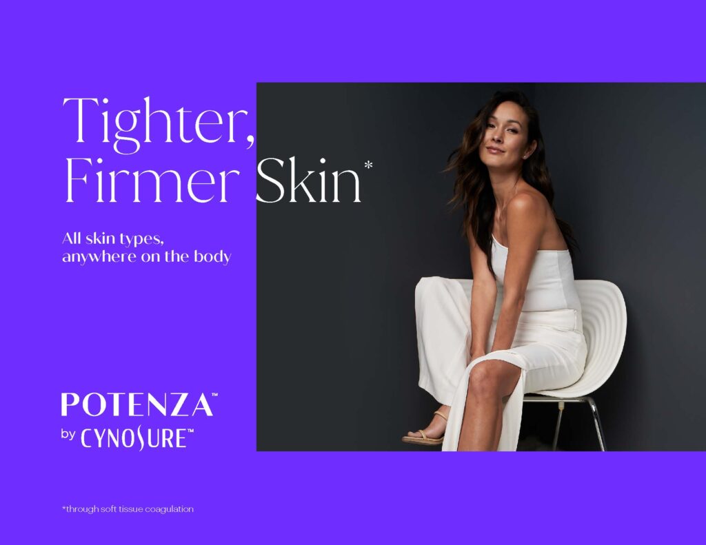 Potenza RF Microneedling Skin Tightening