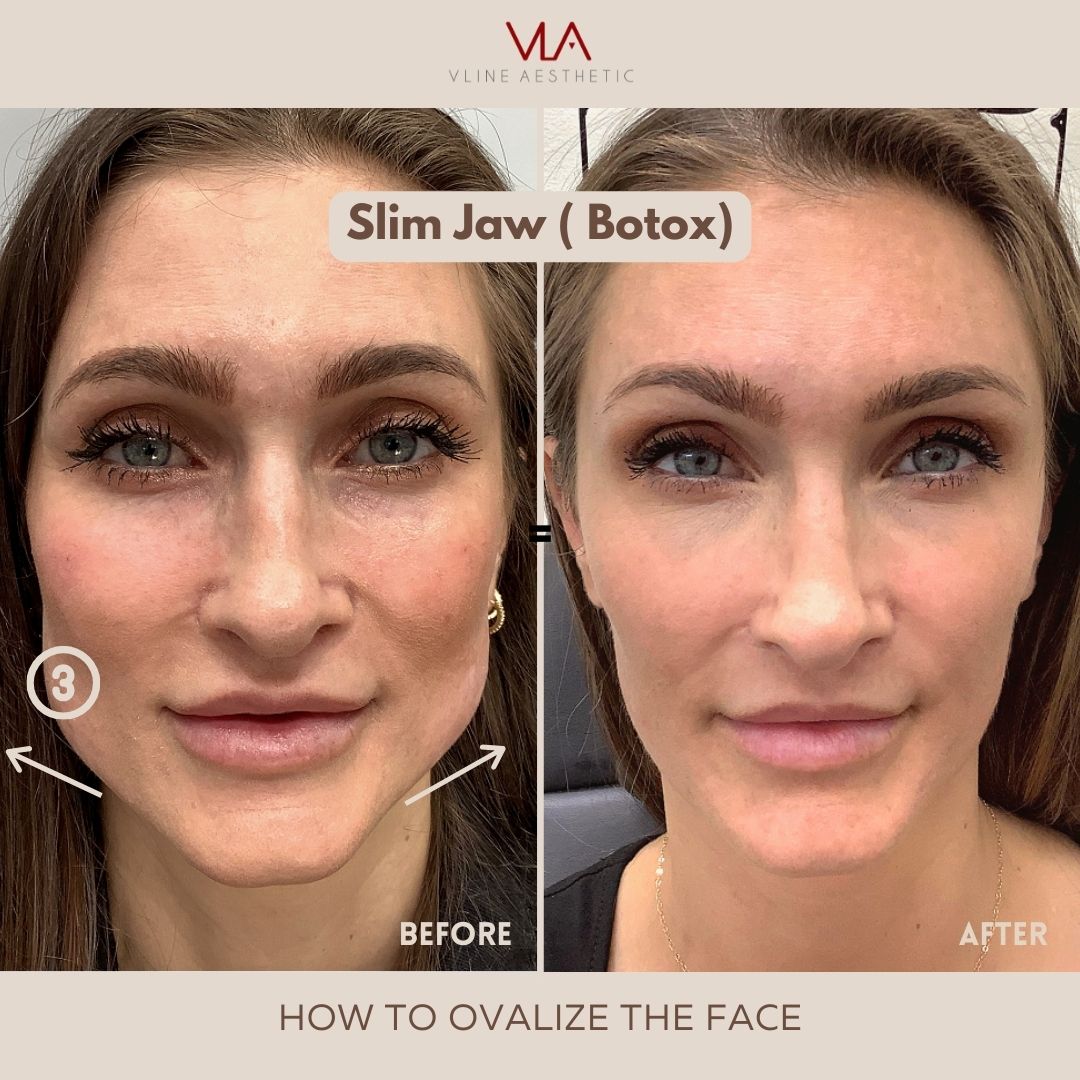 skin perfect brothers how to overlay the face