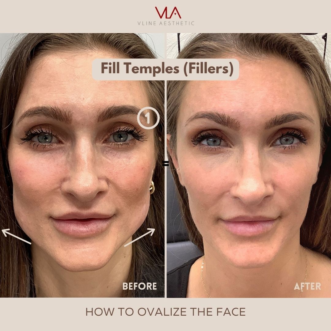 skin perfect brothers how to overlay the face