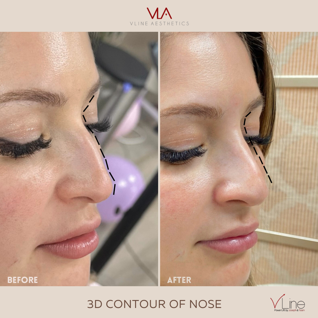 3D nose contour- sarah